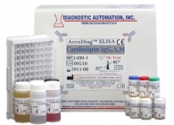 Cardiolipin IgG, A, M ELISA kit