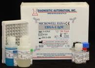 Epstein Barr Virus Nuclear Antigen (EBNA-1) IgM ELISA kit