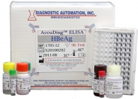 HBeAg ELISA kit