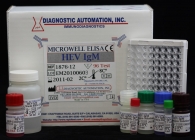 HEV IgM ELISA kit