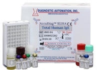 Total Human IgE ELISA kit