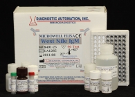 West Nile IgM ELISA kit