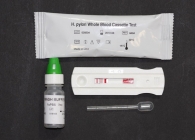 HIV