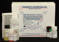 Epstein Barr Virus VCA IgA (EBV, VCA IgA) ELISA test kit