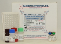 IgE CLIA kit - (Chemiluminescence Immuno Assay)