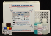 Mycobacterium Tuberculosis (TB) IgG ELISA Test
